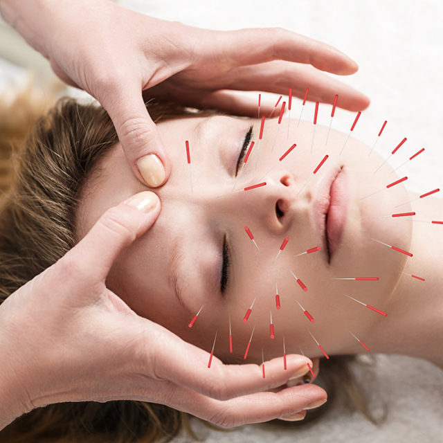 Esthétique du visage