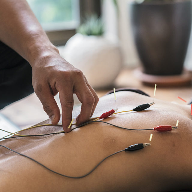 Acupuncture japonaise