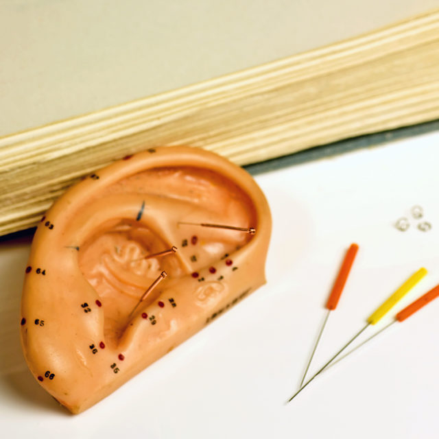 Acupuncture à Lausanne – Sylvie Wyler, 25 ans d'expérience
